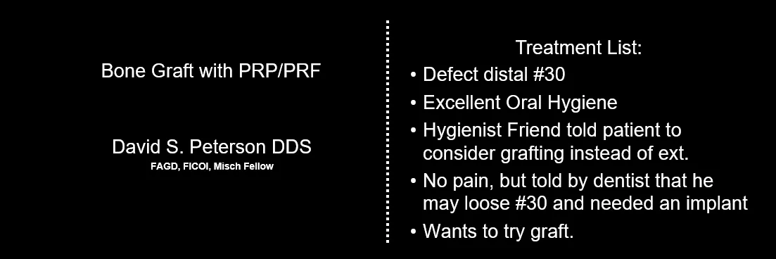 Before and After Bone Graft photo 1