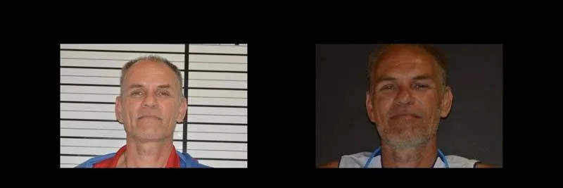 Before and After Full-Mouth Rehabilitation photo 14