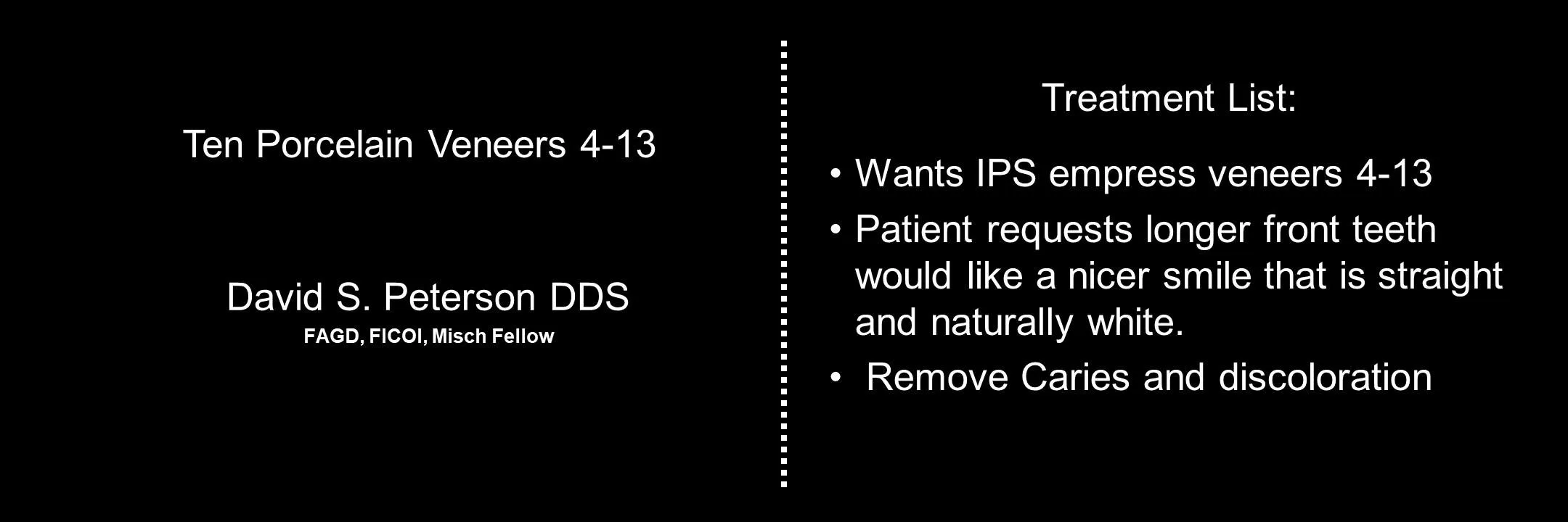 Before and After Porcelain Veneers photo 1
