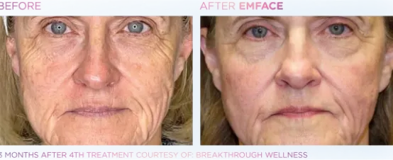 The Dental Studio Aesthetic Tools Before and After Photo 1