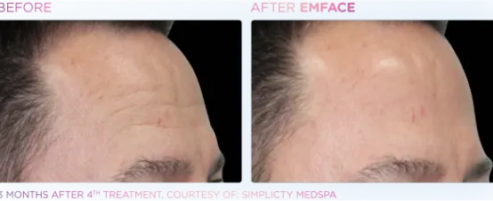 The Dental Studio Aesthetic Tools Before and After Photo 3