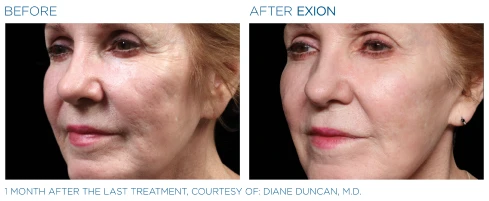 The Dental Studio Aesthetic Tools Before and After Photo 4