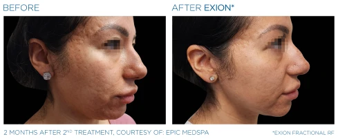 The Dental Studio Aesthetic Tools Before and After Photo 5