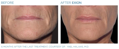 The Dental Studio Aesthetic Tools Before and After Photo 6